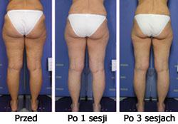 http://www.klinikasfera.pl/wp-content/uploads/2018/05/3.jpg