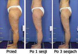 http://www.klinikasfera.pl/wp-content/uploads/2018/05/4.jpg