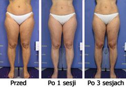 http://www.klinikasfera.pl/wp-content/uploads/2018/05/5.jpg
